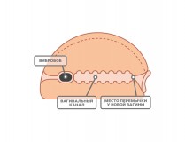 Вибромассажёр для мужчин - вагина биоклон с пультом