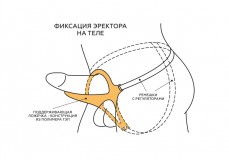Телесный эректор-ложечка с фиксацией на ремешках MEN STYLE